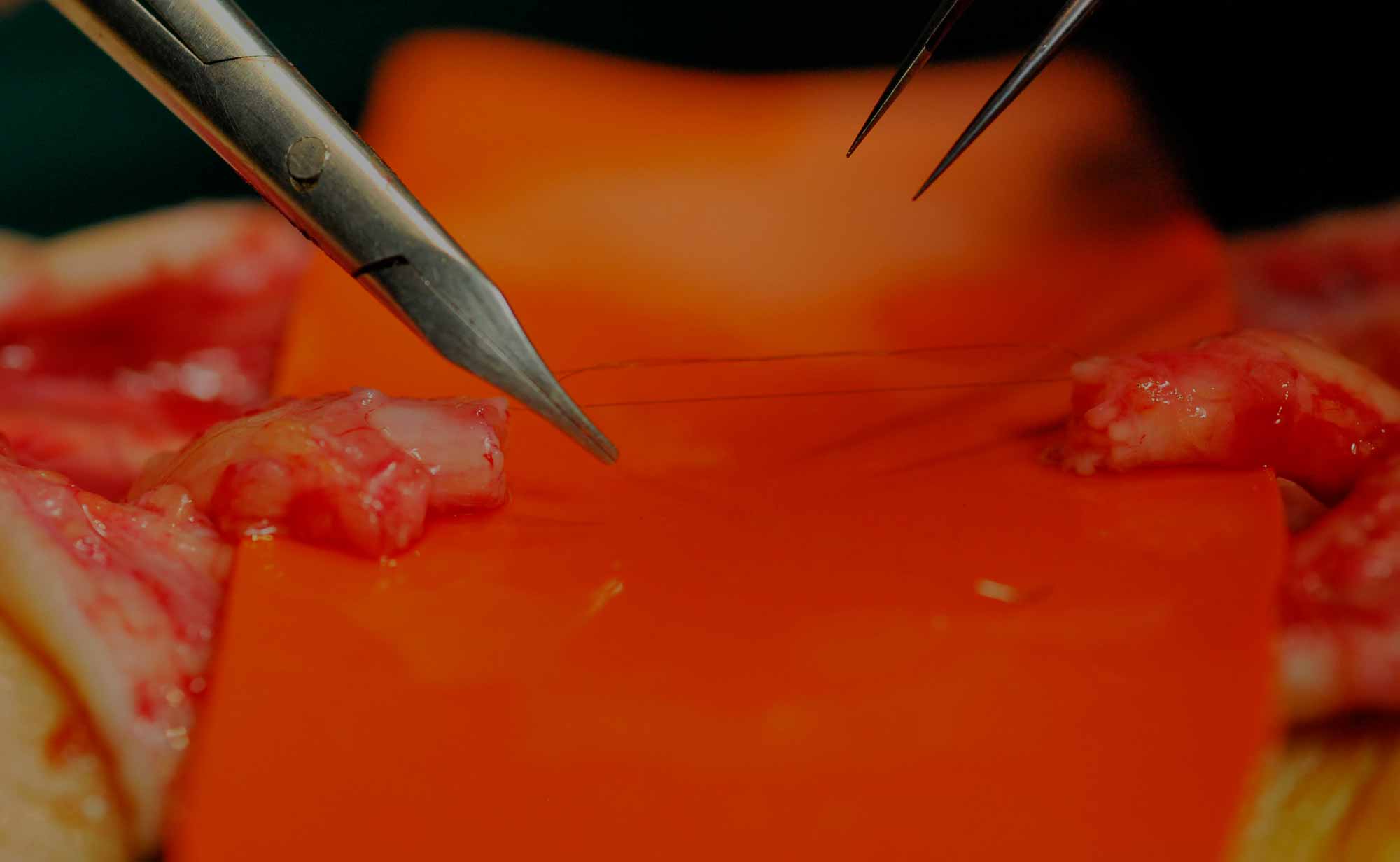 cirugia-nervio-periferico-orthoplastic